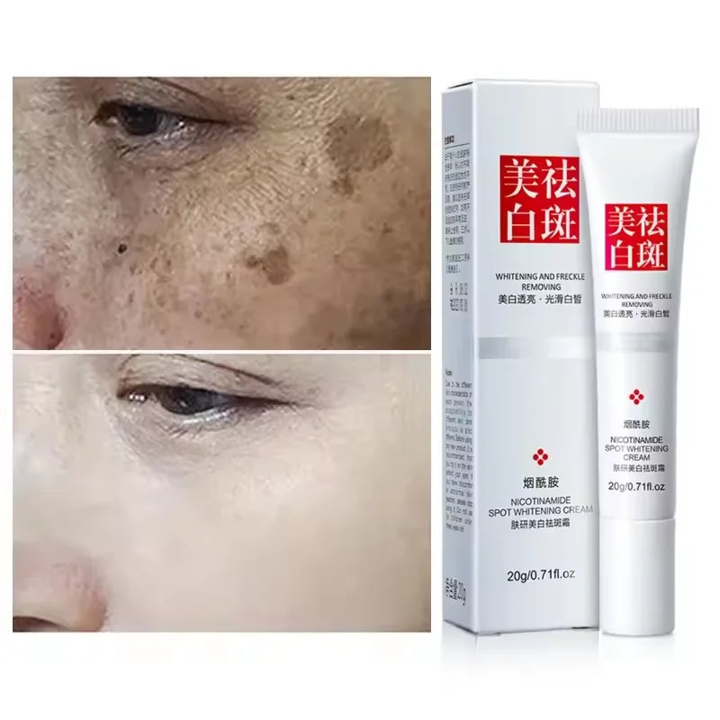 Crème anti-taches & anti-taches de rousseur – Blanchissante, Éclat & Soin du visage