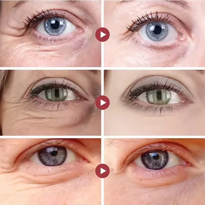 Crème contour des yeux anti-poches & anti-cernes – Rétinol, Anti-rides & Raffermissante