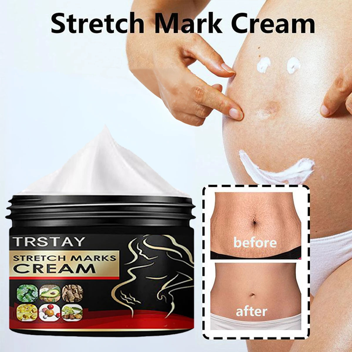 Creme Anti-Vergetures Maternite TRSTAY - Soin Reparateur & Hydratant 50ml