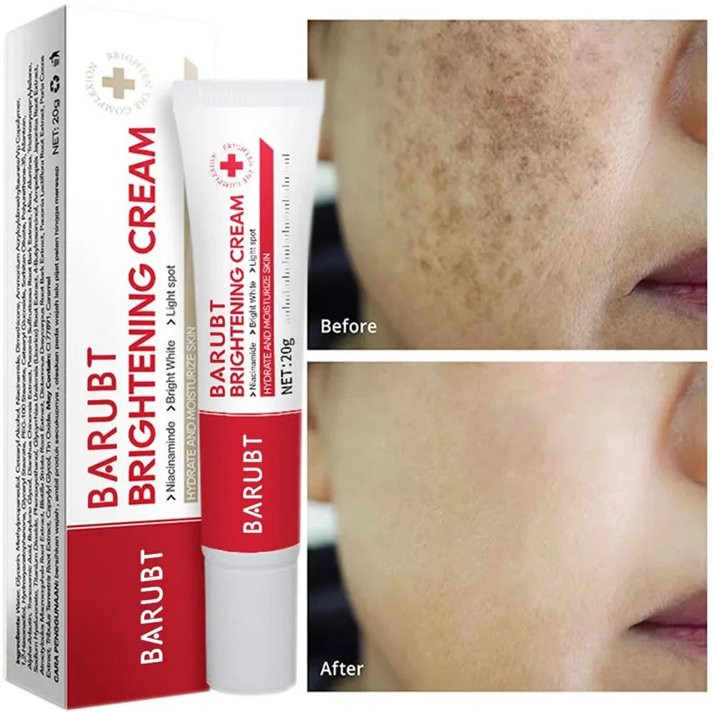 Crème blanchissante anti-taches & anti-taches de rousseur – Éclat, Hydratation & Anti-âge