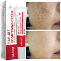 Crème blanchissante anti-taches & anti-taches de rousseur – Éclat, Hydratation & Anti-âge