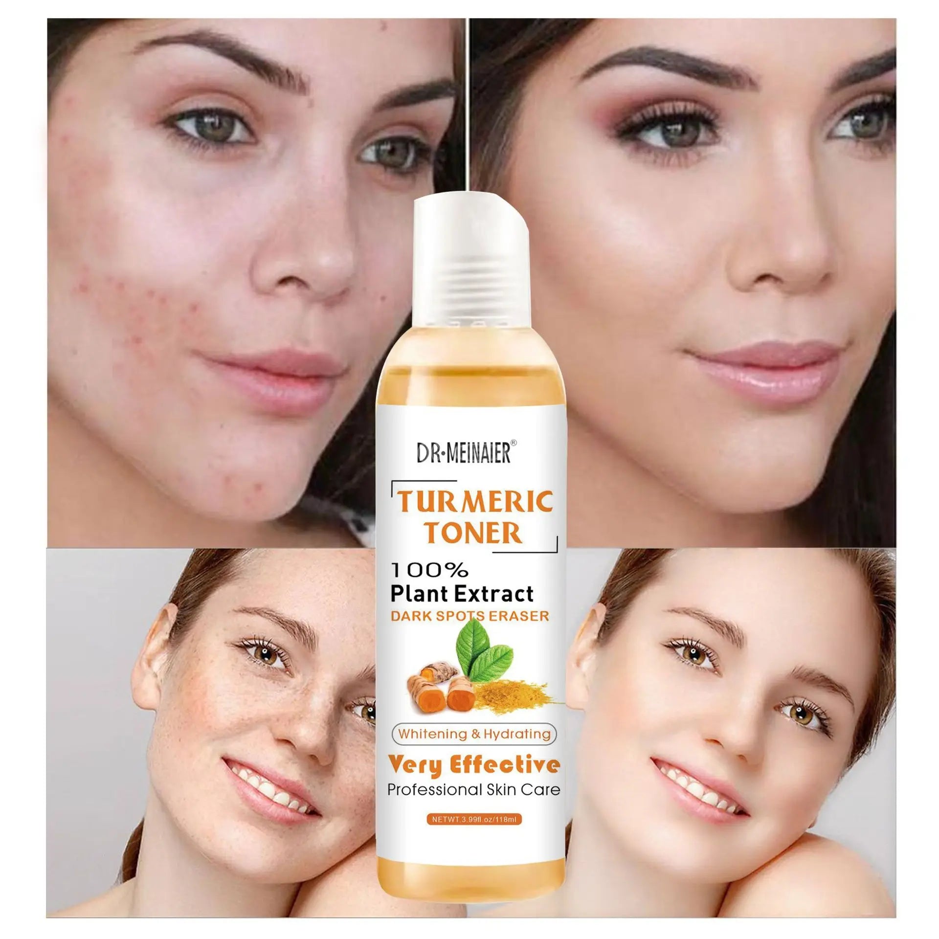 Toner au Curcuma 118ml – Correcteur de Taches, Anti-Acné & Éclat pour Peaux Foncées