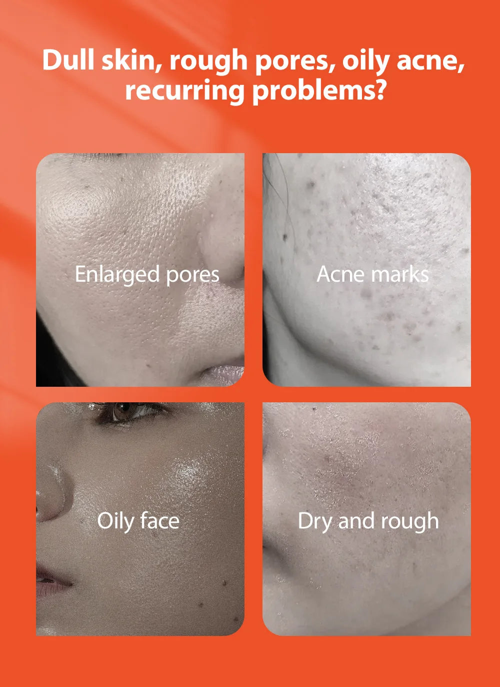 Crème Anti-Acne aux Herbes PWYUMAN - Soin Purifiant en profondeur