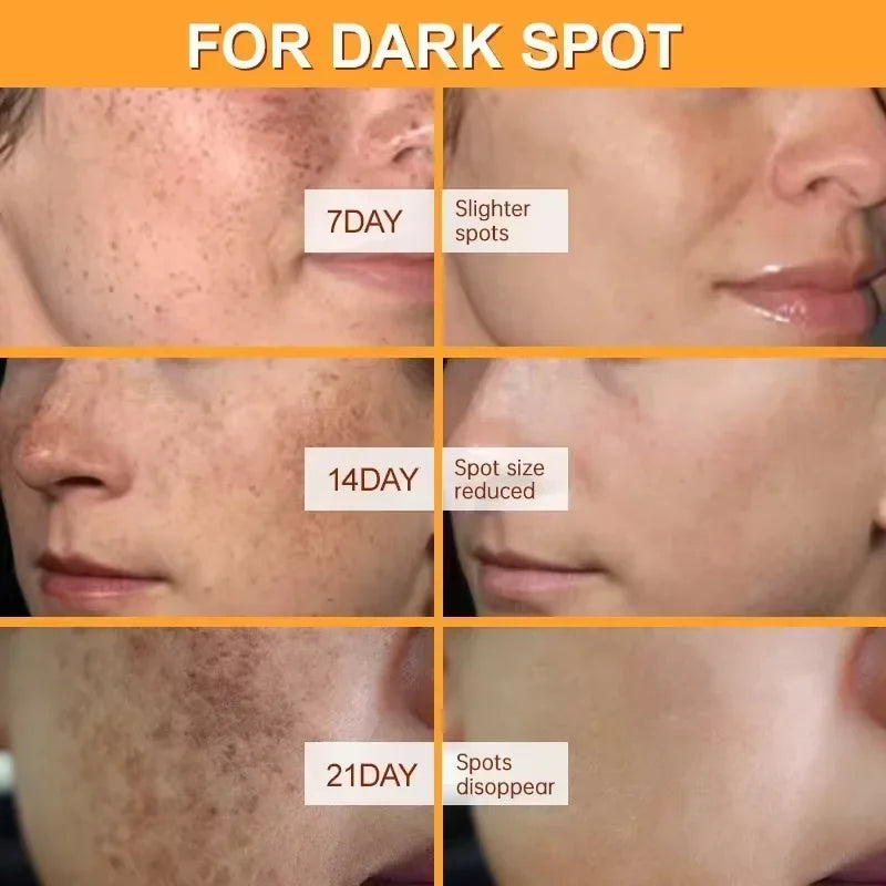 Crème blanchissante anti-taches & anti-taches de rousseur – Éclat, Hydratation & Anti-âge