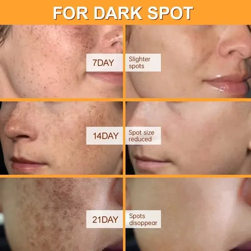 Crème blanchissante anti-taches & anti-taches de rousseur – Éclat, Hydratation & Anti-âge