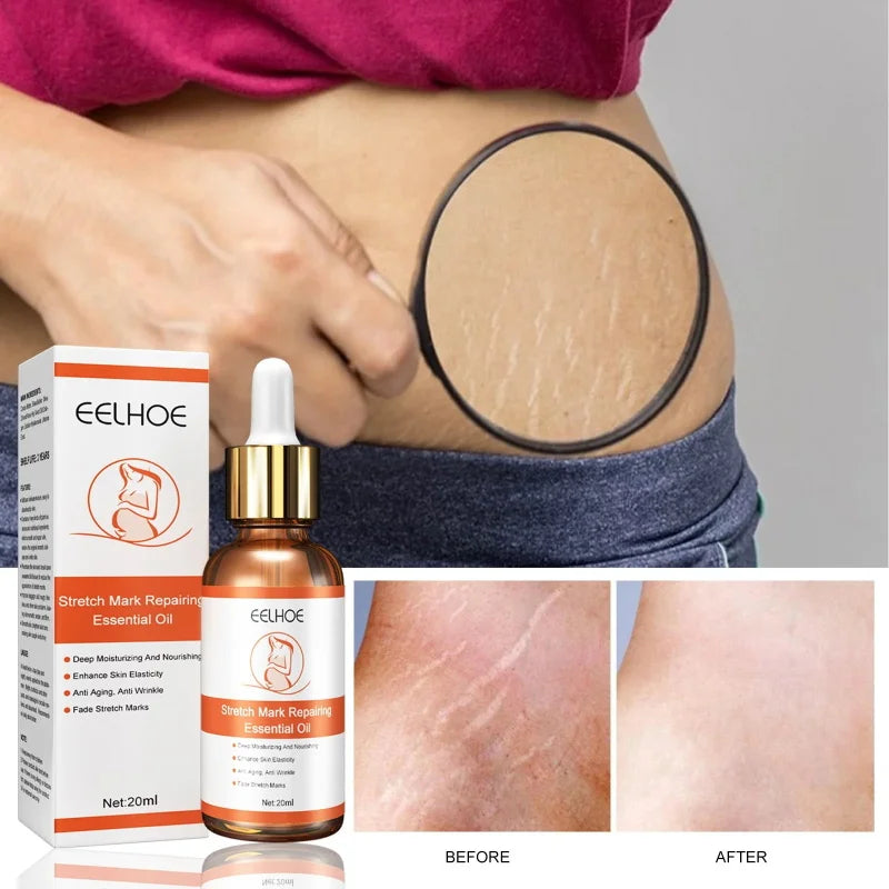 Sérum Huile Essentielle Anti-Vergetures - Soin Maternite