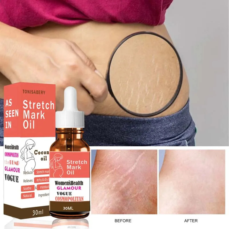 Sérum Huile Essentielle Anti-Vergetures - Soin Maternite