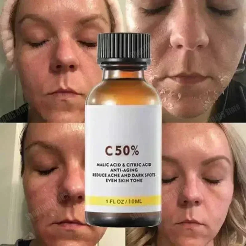 Essence anti-acné & anti-taches – Exfoliant chimique à l'acide salicylique, Anti-âge & Hydratante