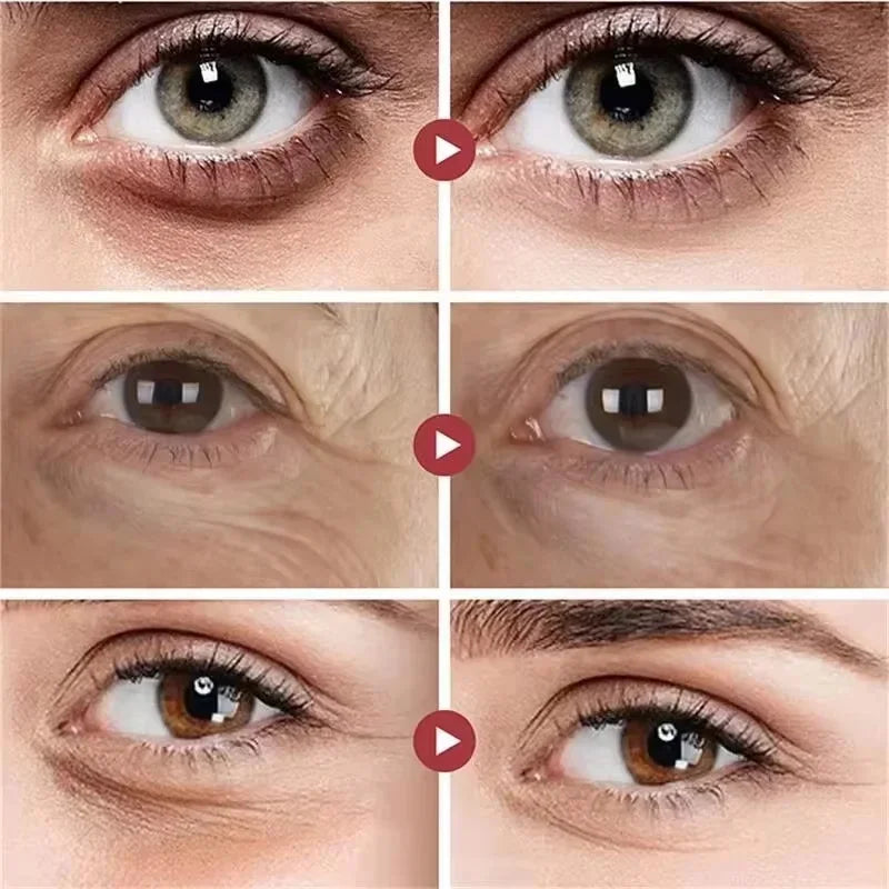 Crème yeux au Rétinol – Anti-rides, Raffermissante & Anti-cernes instantanés