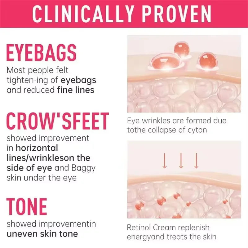 Crème contour des yeux anti-poches & anti-cernes – Rétinol, Anti-rides & Raffermissante