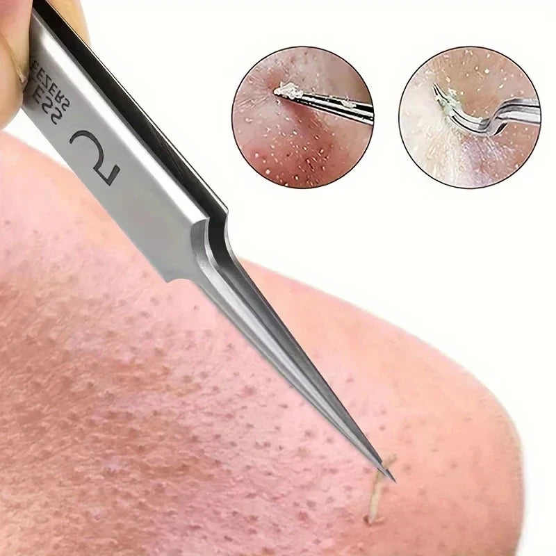 Pince Professionnelle Anti-Points Noirs N°5 – Extraction Précise & Indolore pour une Peau Nette