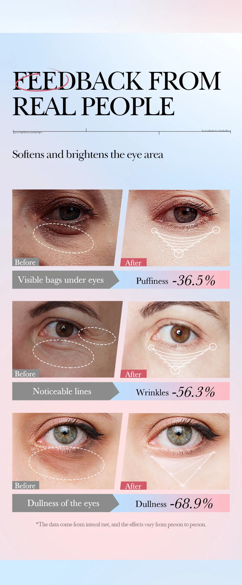 Crème contour des yeux anti-poches & anti-cernes – Rétinol, Anti-rides & Raffermissante