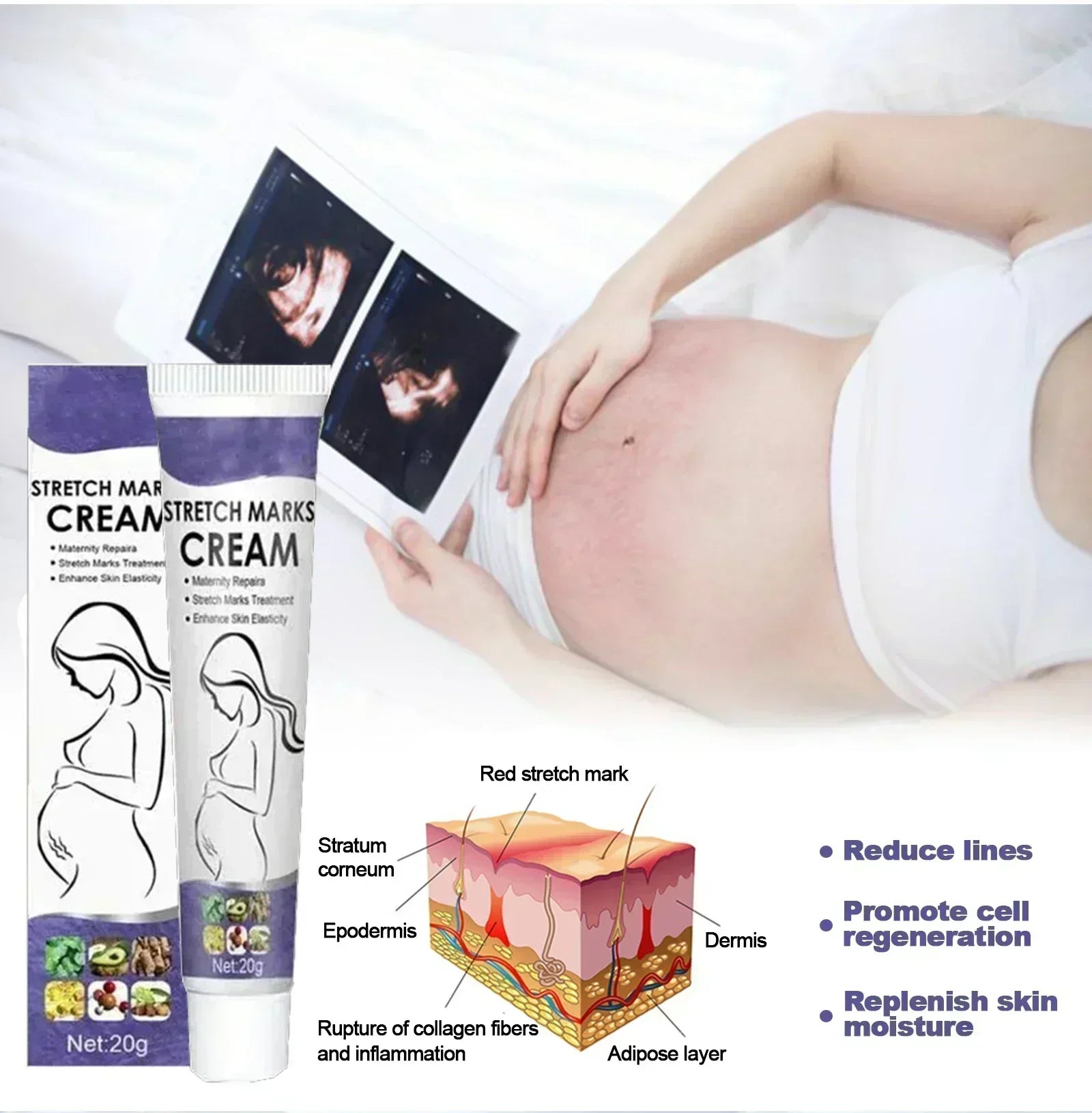 Creme Anti-Vergetures eelhoe