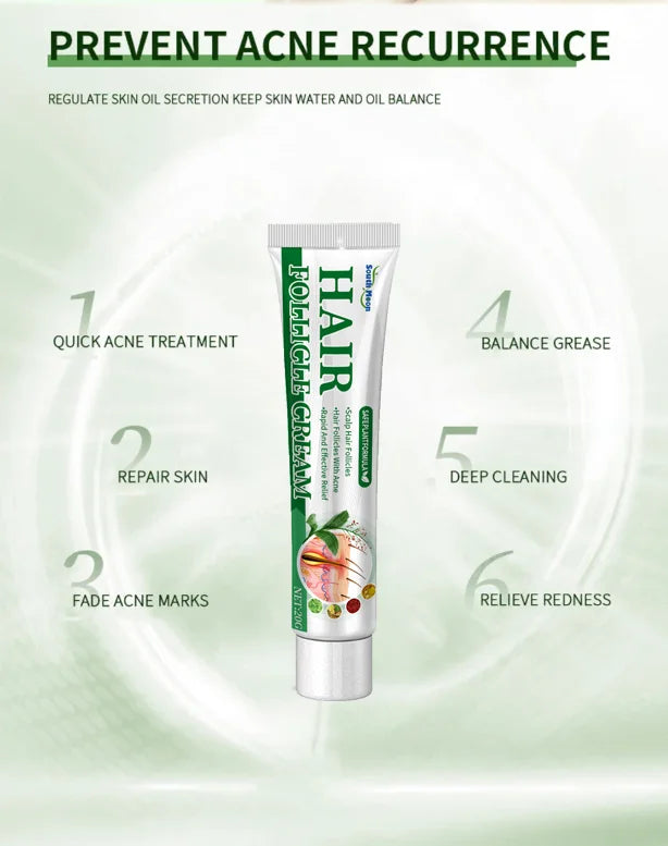 Crème anti-acné & anti-boutons – Élimine nodules, kystes, points noirs & imperfections