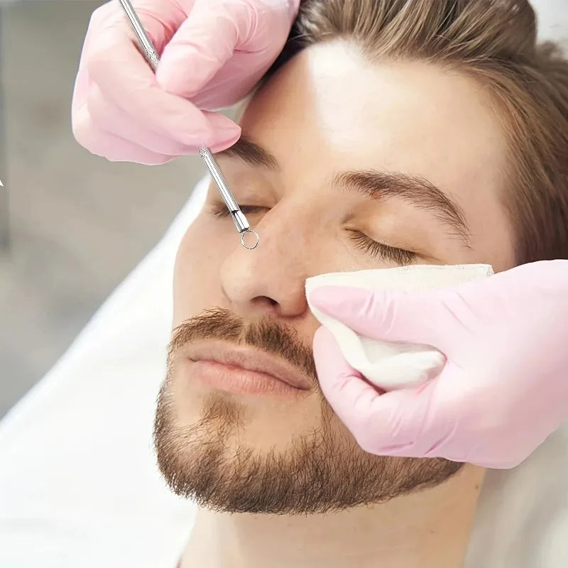 Kit d'Extraction Points Noirs & Acne - 6 Outils Professionnels en Acier Inoxydable