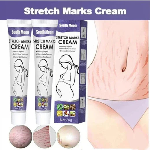 Skin Care Improves Elasticity Effective After Pregnancy Stretch Marks Removal Powerful Maternity Cream Nourishes Skin