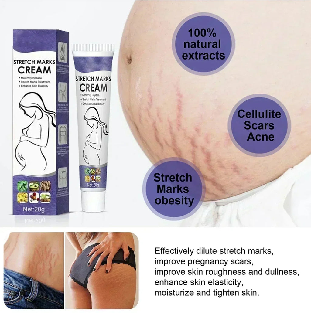 Creme Anti-Vergetures eelhoe