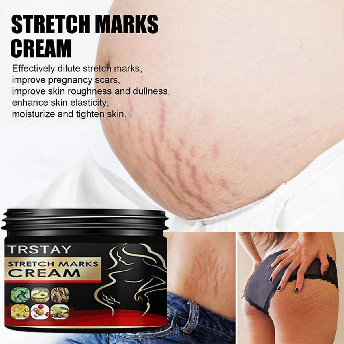 Creme Anti-Vergetures Maternite TRSTAY - Soin Reparateur & Hydratant 50ml