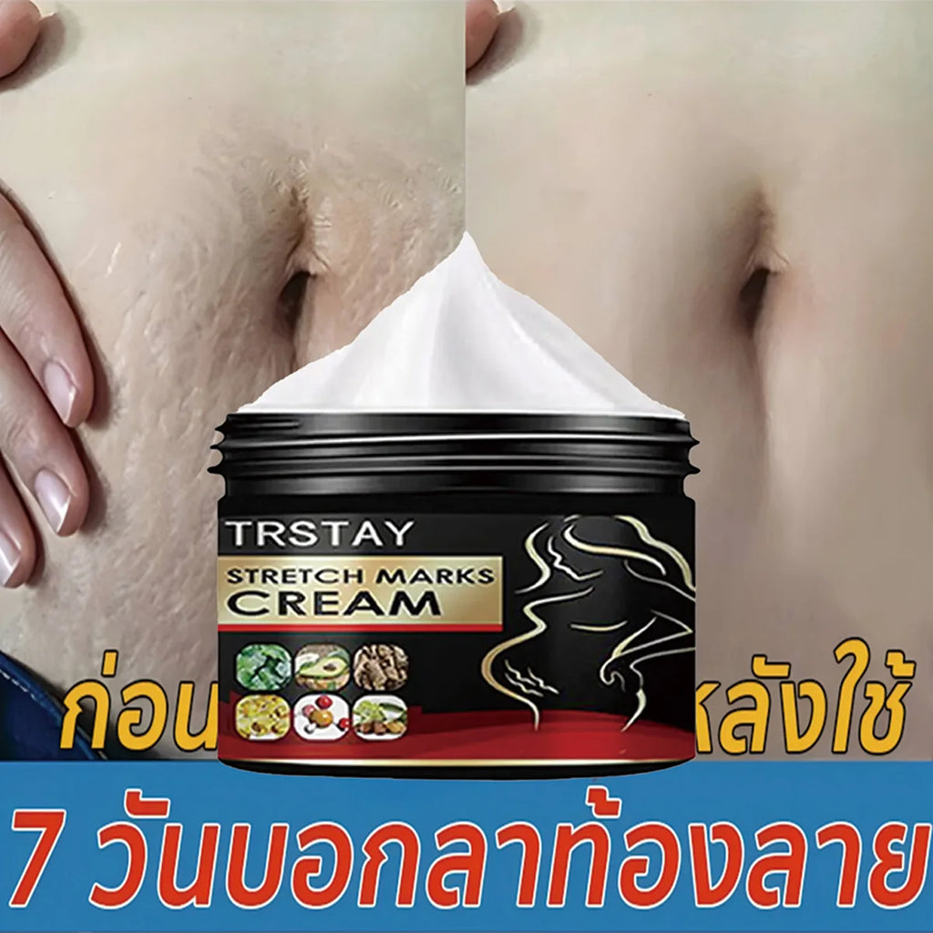 Creme Anti-Vergetures Maternite TRSTAY - Soin Reparateur & Hydratant 50ml