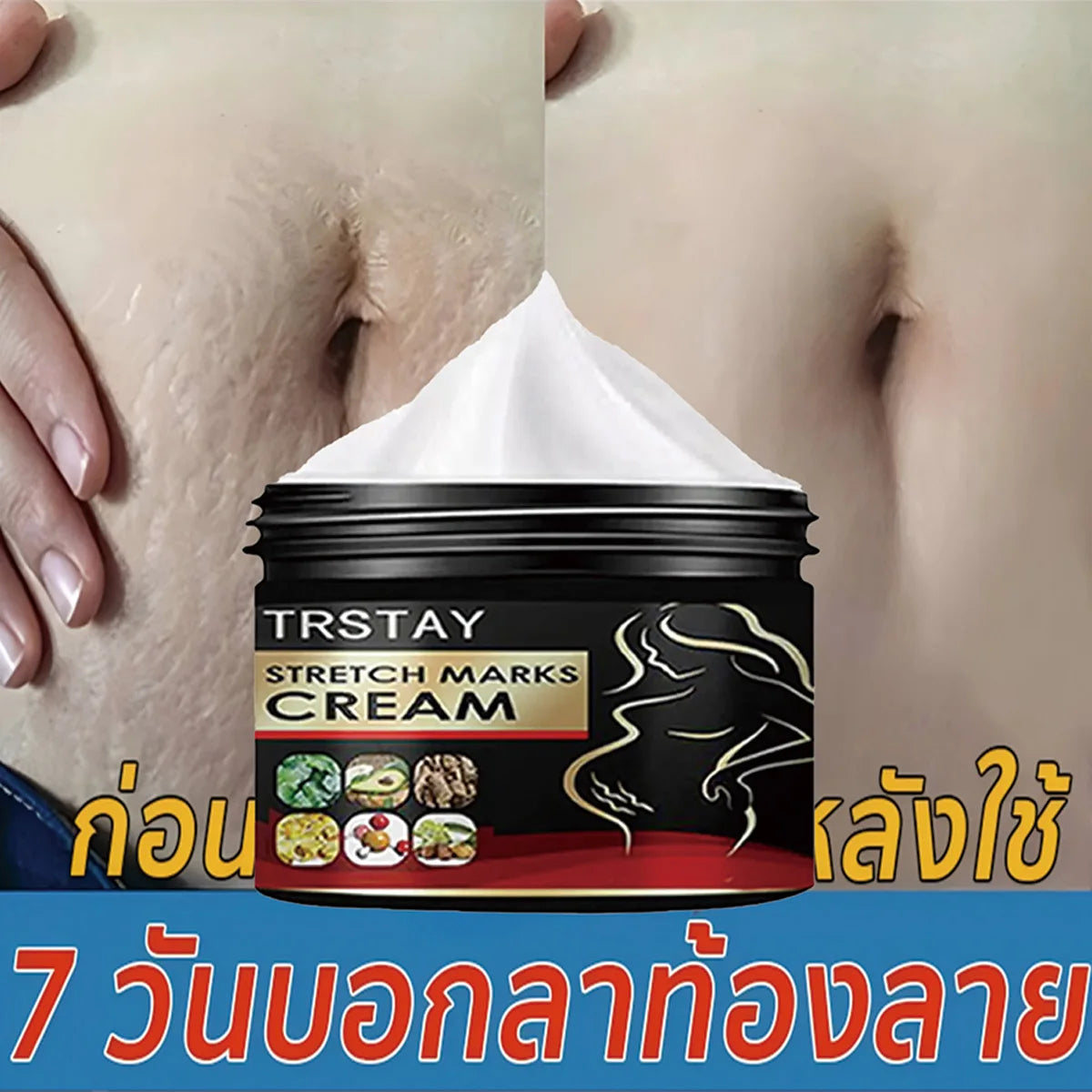 Creme Anti-Vergetures Maternite TRSTAY - Soin Reparateur & Hydratant 50ml