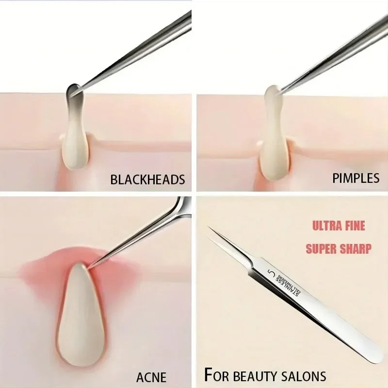 Pince Professionnelle Anti-Points Noirs N°5 – Extraction Précise & Indolore pour une Peau Nette