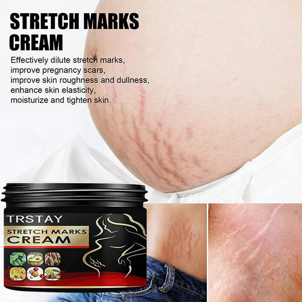 Creme Anti-Vergetures Maternite TRSTAY - Soin Reparateur & Hydratant 50ml