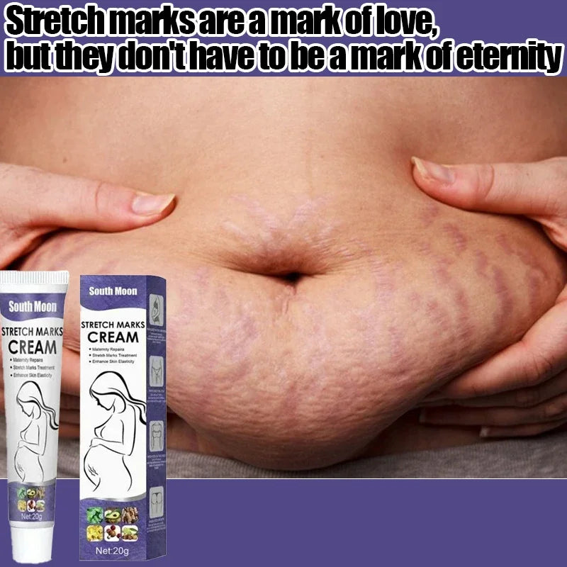 Creme Anti-Vergetures eelhoe