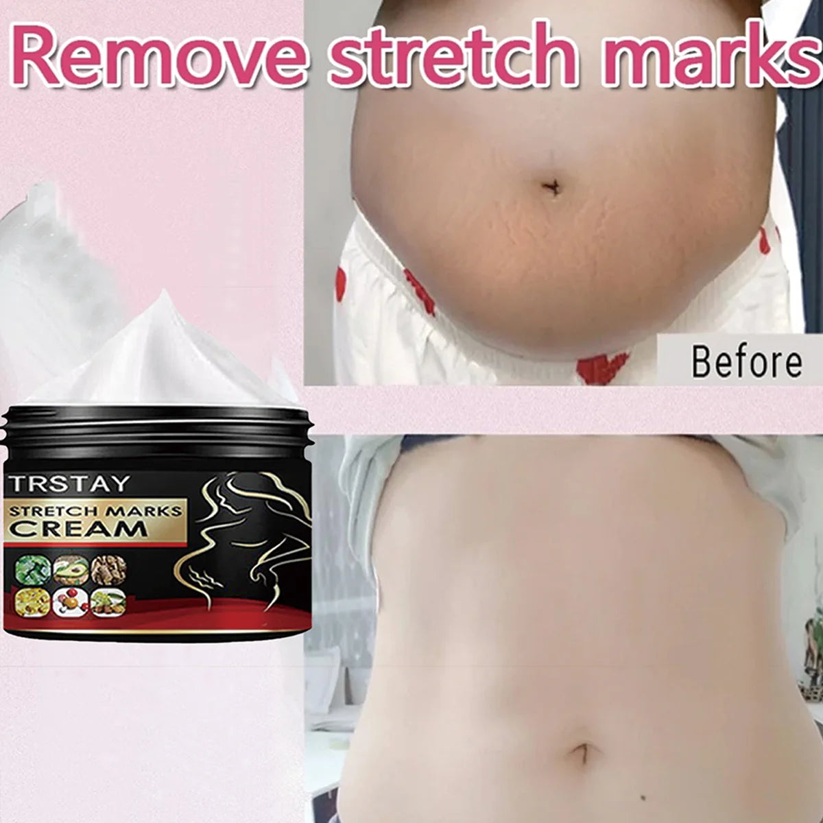 Creme Anti-Vergetures Maternite TRSTAY - Soin Reparateur & Hydratant 50ml