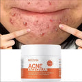 Crème Anti-Acne aux Herbes PWYUMAN - Soin Purifiant en profondeur